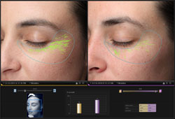 VISIA: ������������� ��������� �����������