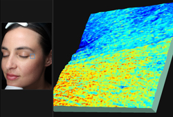 VISIA: 3D-�������� ������� ����