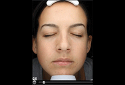 VISIA: ����������� ��������� �������� ����