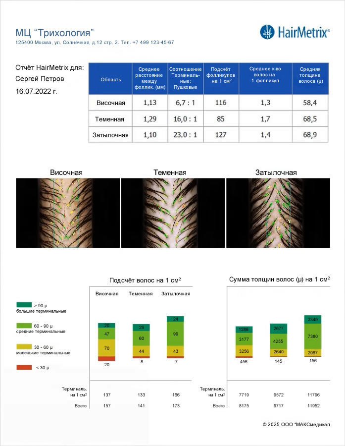 ��������� HairMetrix: ������ ��������� ������