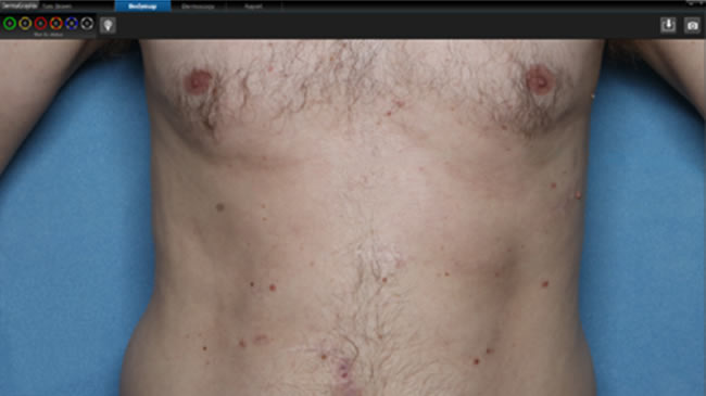 ����� ��������� ������ ��������� DermaGraphix