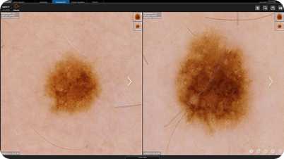 ��������� DermaGraphix: c������������ ����������� � ������������������ �������