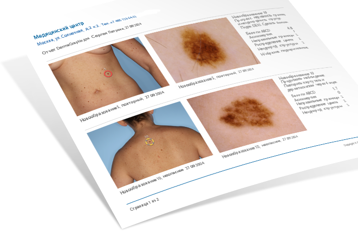 �������� ����� ��������� DermaGraphix