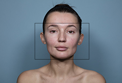 ������������� ���� IntelliStudio DermaGrapfix