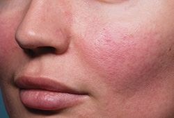 ���������������� ������ ���� IntelliStudio DermaGraphix