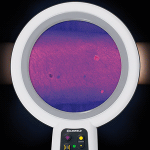 ������ ��������� ����������� ������������ ������