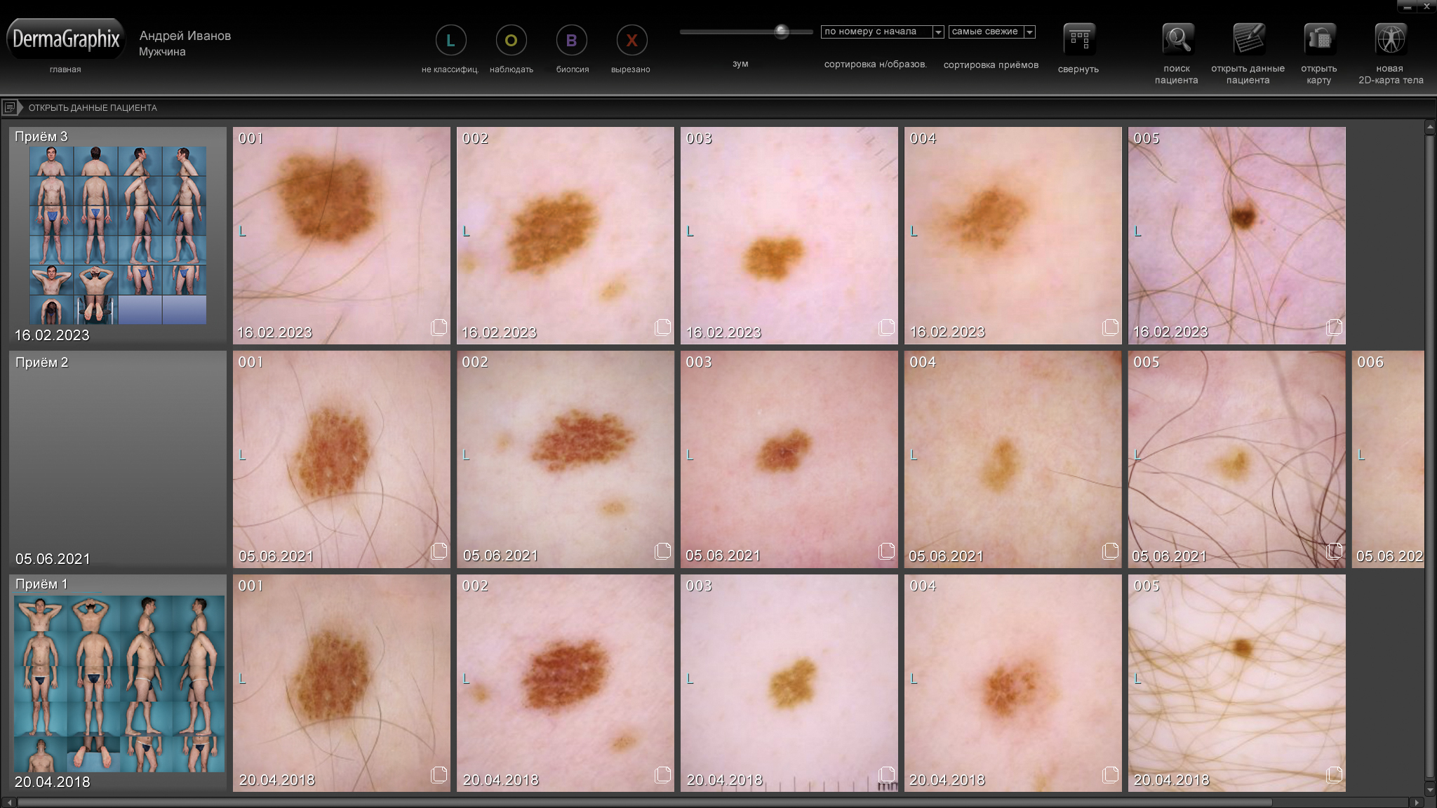 ��������� DermaGraphix: ������ ����������