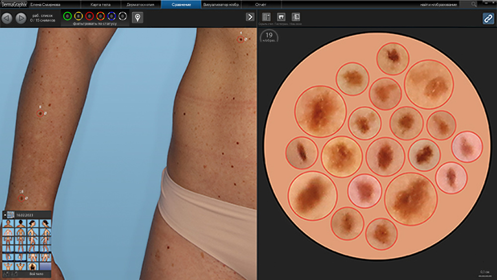 ��������� DermaGraphix: ������������ ���������������