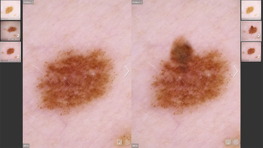 ��������� DermaGraphix: ��������� �����������