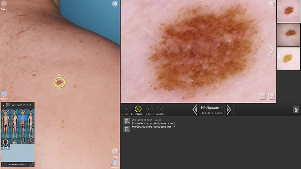 ��������� DermaGraphix: �������� ������������������ �������