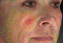 VECTRA XT: ������������ ������������ Canfield