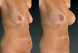 VECTRA XT: �������������� ���� ���� � ����