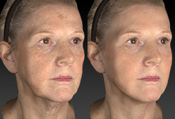 VECTRA M3: ������������� ����� ��������