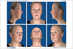 VECTRA M3: �������� ������