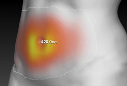 VECTRA H2: ������� ����� ��������� ������
