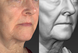 VISIA 3D: ����� �������� ������