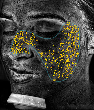 VISIA: ������������� ����������� ���� - ��-�����