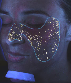 VISIA: ������������� ����������� ���� - ���������