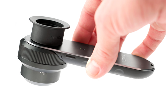 ������������ �������� (DermLite)