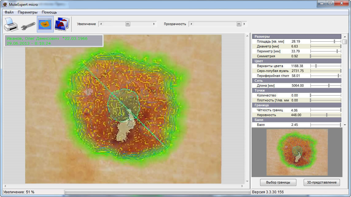 ��������� MoleExpert mictro