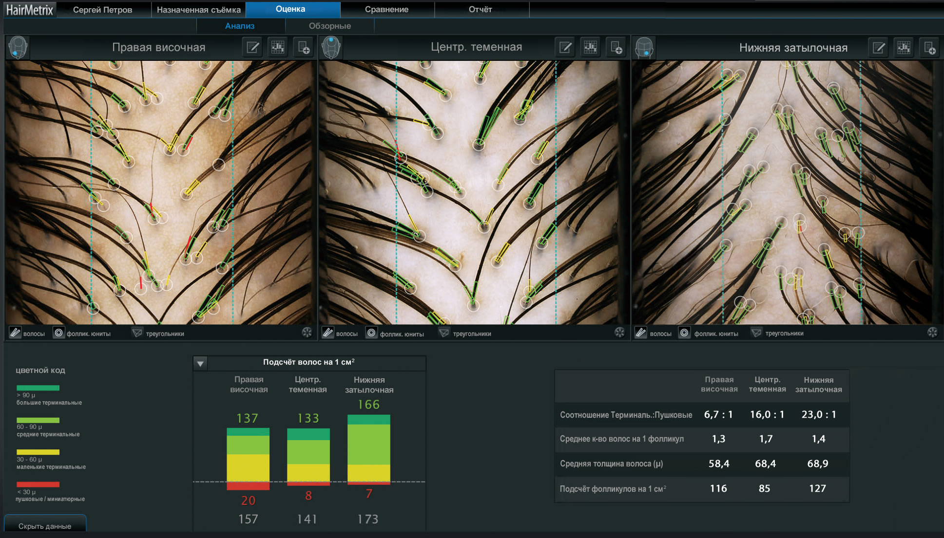  Hairmetrix: 