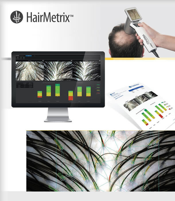 Программа для трихоскопии HairMetrix