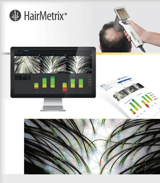 HairMetrix