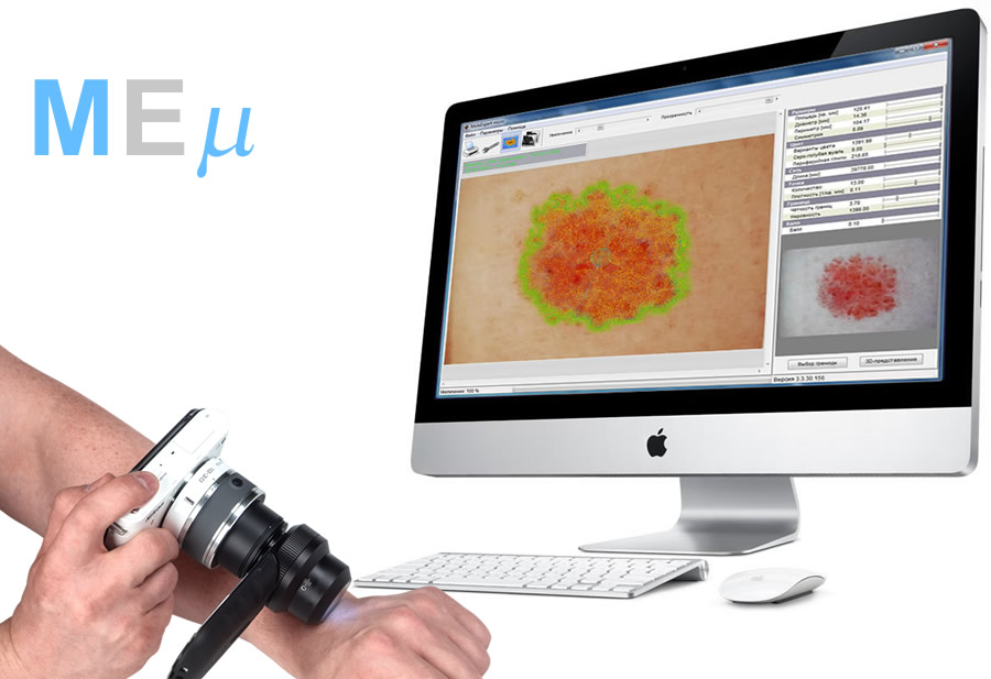 Программа MoleExpert micro