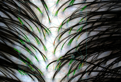  HairMetrix:     