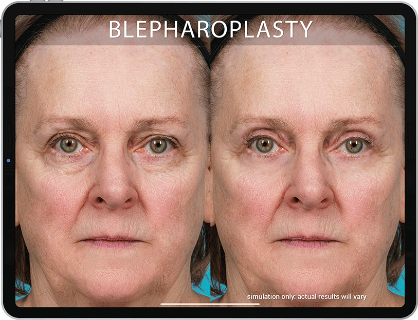 ����������� ��������� ��������� Mirror