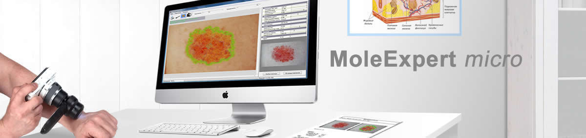   MoleExpert